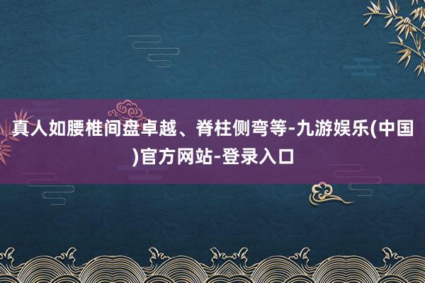 真人如腰椎间盘卓越、脊柱侧弯等-九游娱乐(中国)官方网站-登录入口