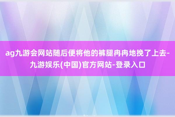 ag九游会网站随后便将他的裤腿冉冉地挽了上去-九游娱乐(中国)官方网站-登录入口